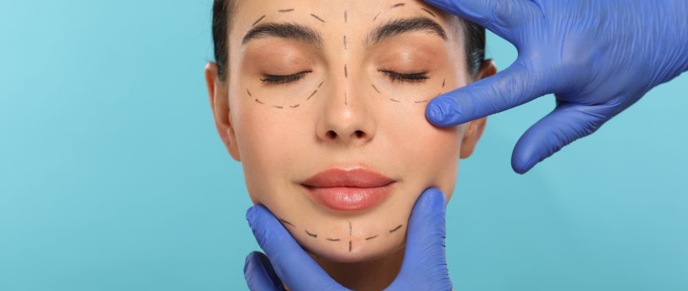 armonizacion facial madrid tercio inferior